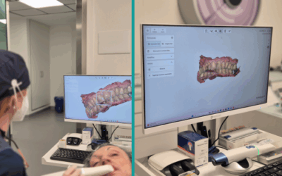 Impronta dentale digitale: l’innovazione che rivoluziona l’odontoiatria