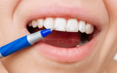 White spots: cosa sono e come eliminarle