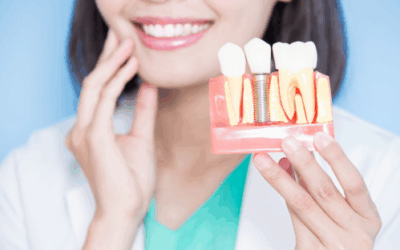 Impianto osteointegrato: cos’è e come funziona