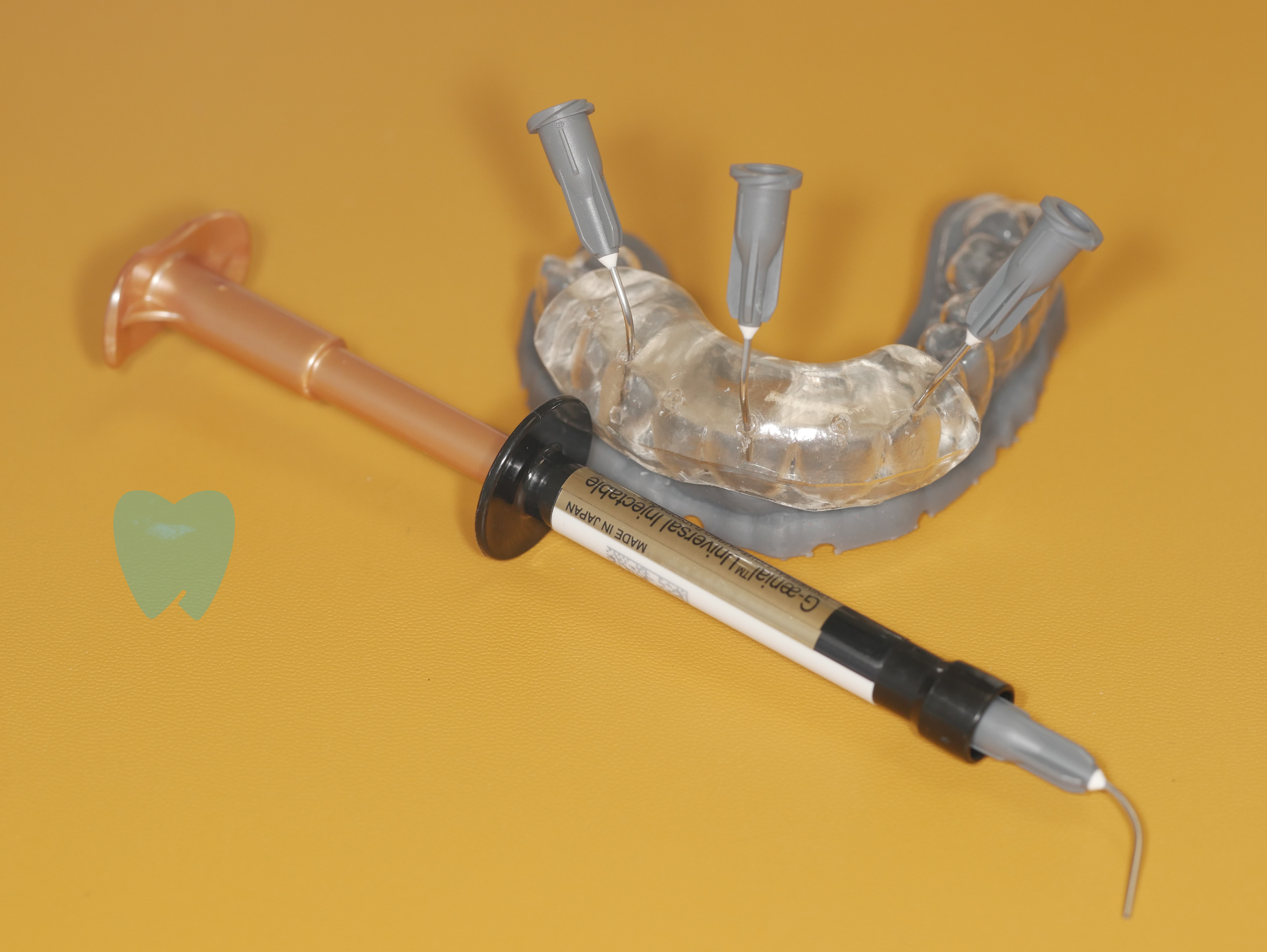 Confronto prima e dopo il trattamento dentale estetico, con miglioramento del sorriso grazie a faccette dentali su denti anteriori.