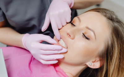 Tartaro ai denti: perché si forma e come prevenirlo