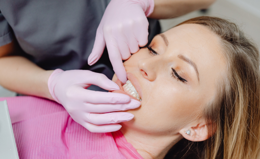 tartaro denti