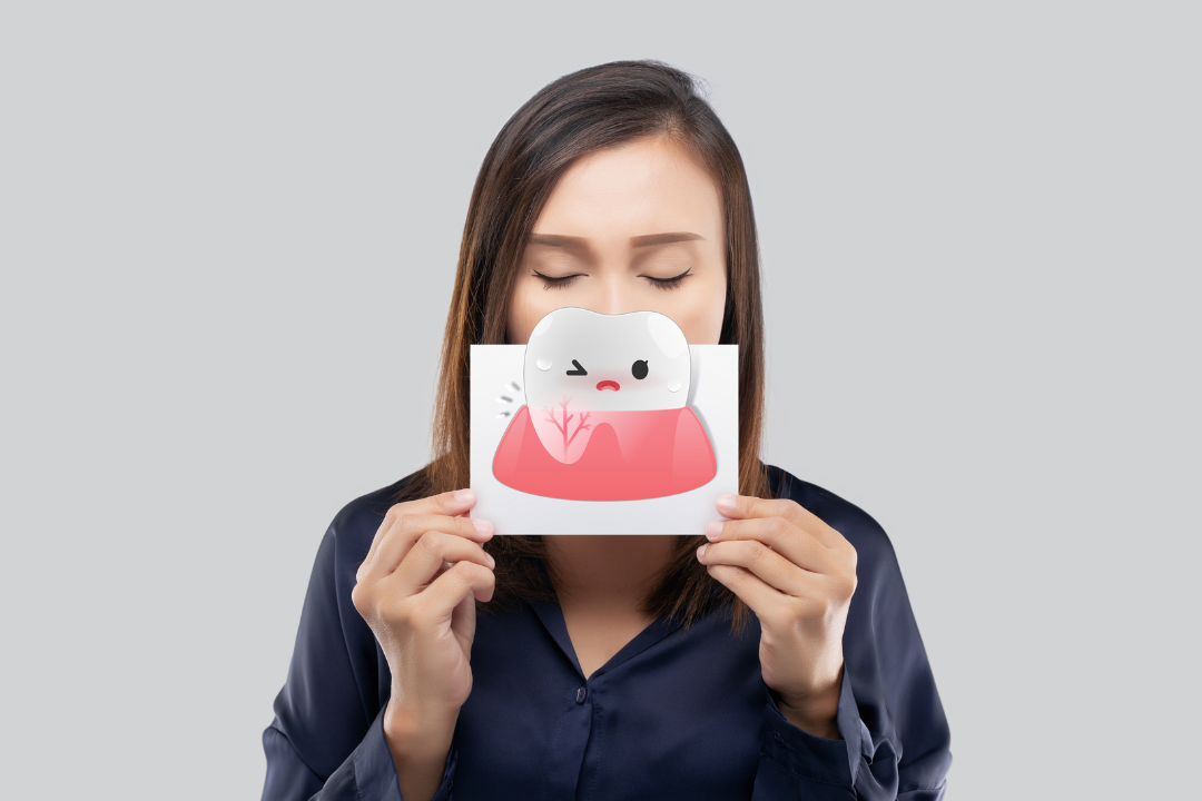 ascesso alla gengiva