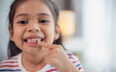Denti da latte che non cadono: quando preoccuparsi?