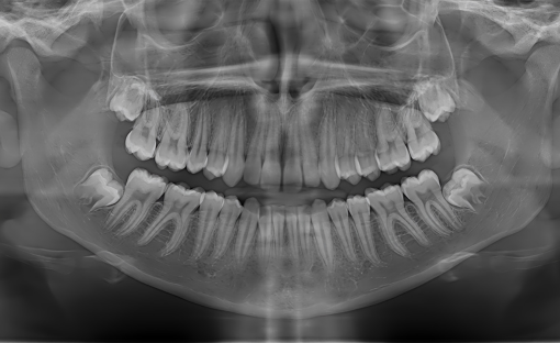 denti del giudizio