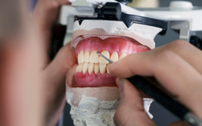 Apicectomia dentale: quando è necessaria, come si esegue e tempi di guarigione