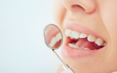 Denti che si muovono da adulti: cosa fare?