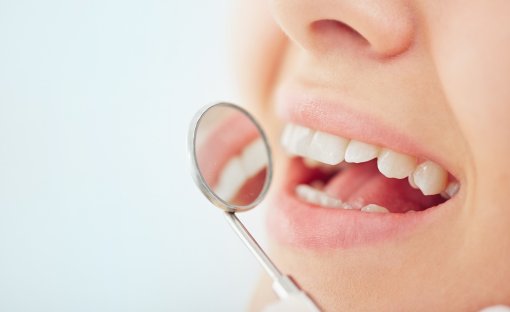 Denti che si muovono da adulti: cosa fare?